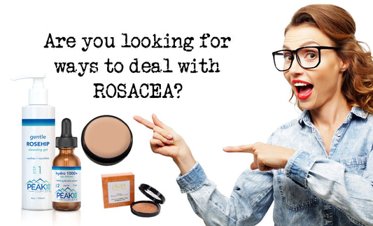 Rosacea: How to minimize the appearance!