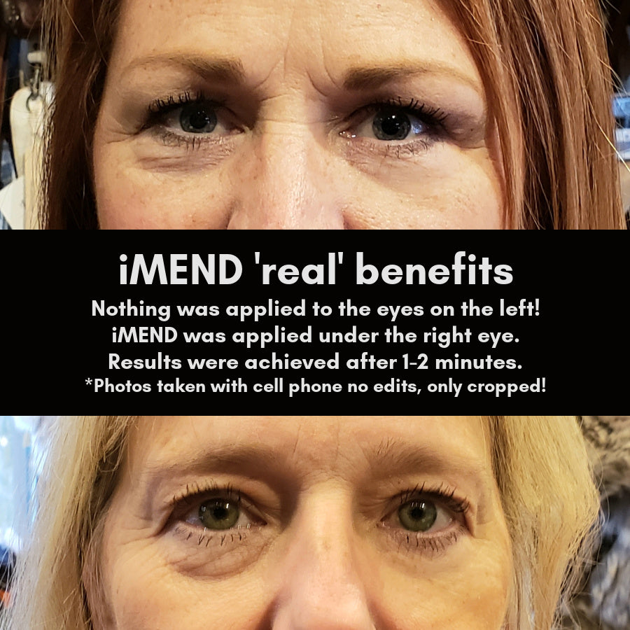 iMEND instant + lasting tightening .5oz