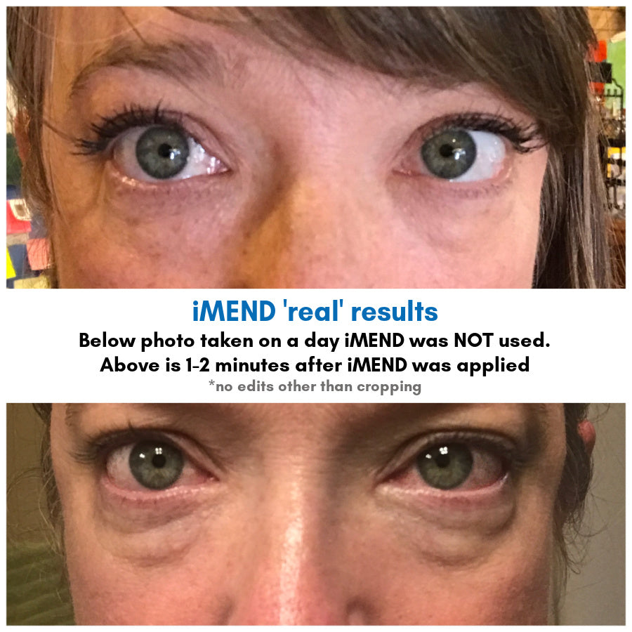 iMEND instant + lasting tightening .5oz