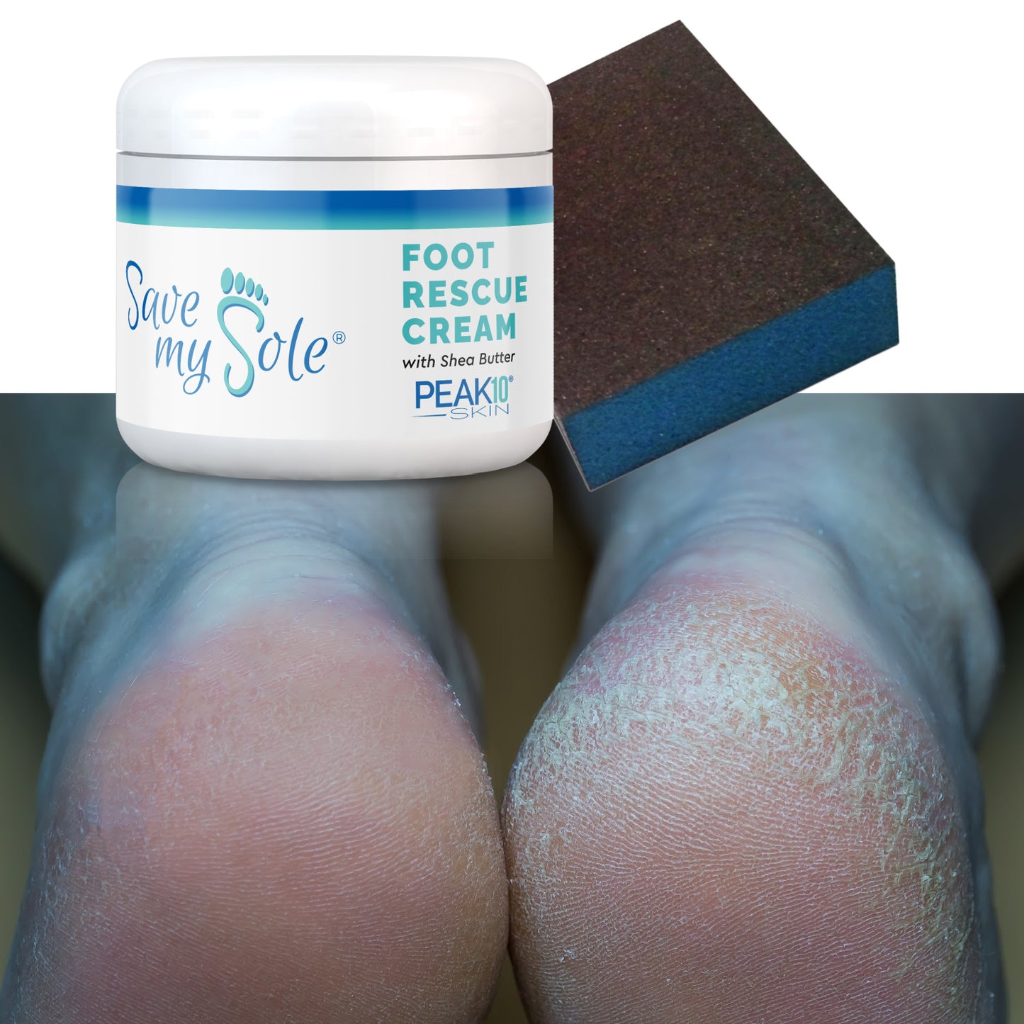 SAVE MY SOLE® foot rescue cream 4.2 oz w/Exfoliating Smoothing Block