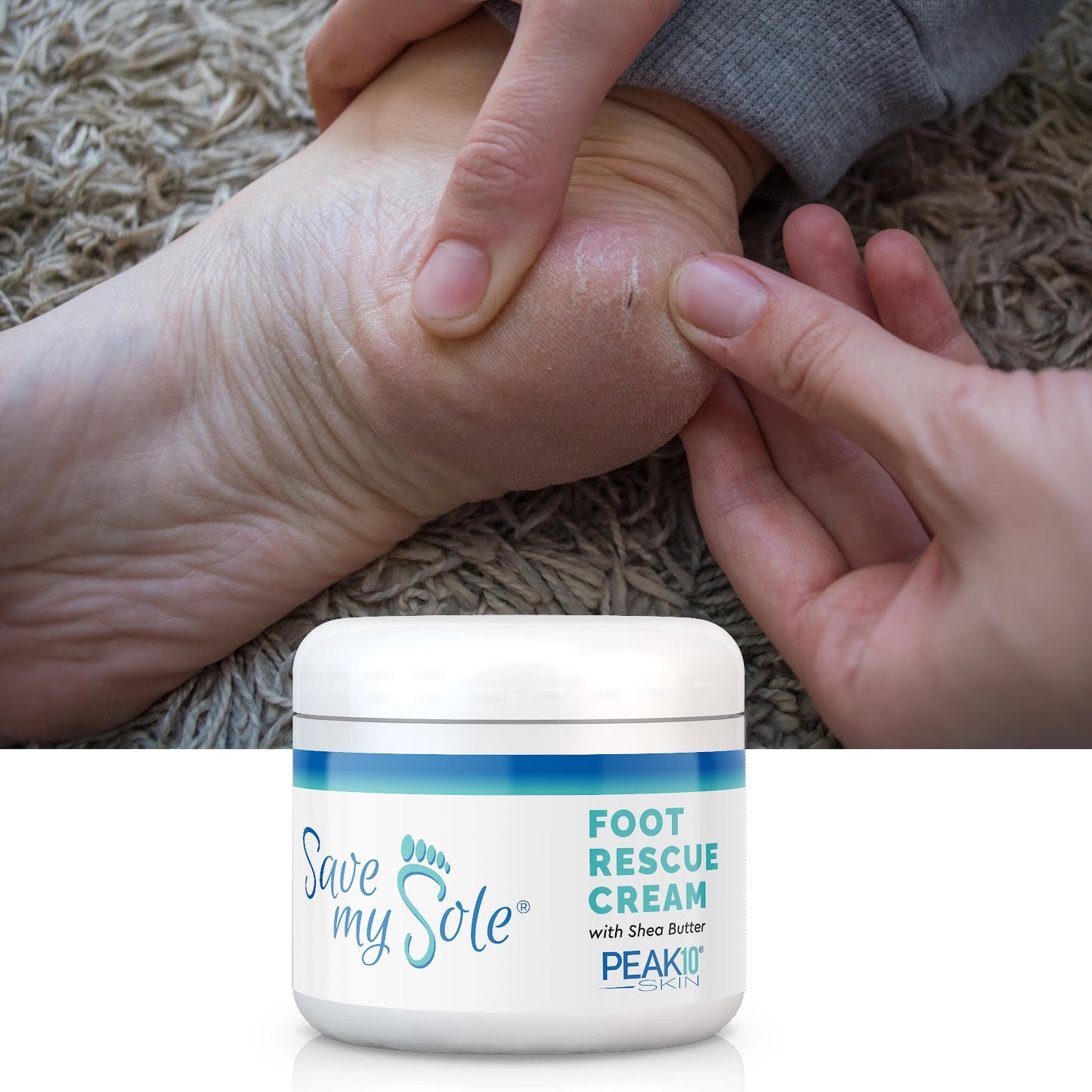 SAVE MY SOLE® foot cream w/Shea Butter 4.2 oz